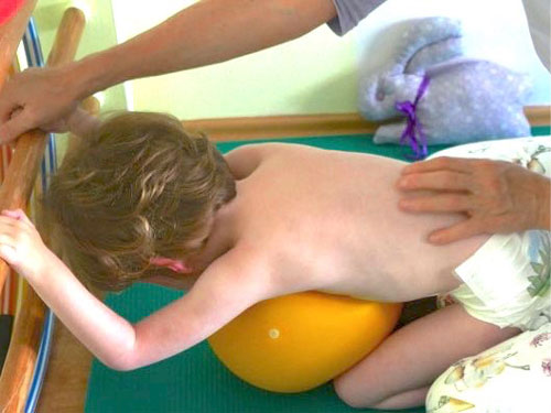 Dítě při rehabilitaci citlivě vedené rukama fyzioterapeutky.